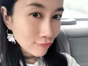 女演员贵州拍戏遇极端天气 胳膊受伤