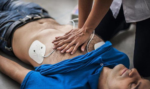 目击者回应男子心肺复苏被指袭胸(目击者视角下的男子心肺复苏事件，关于被指袭胸的真相探讨)